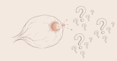 Ovulation tardive