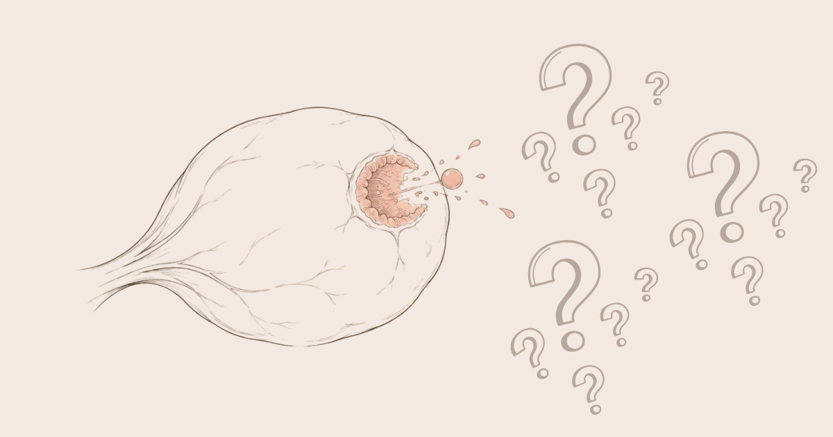 Ovulation tardive